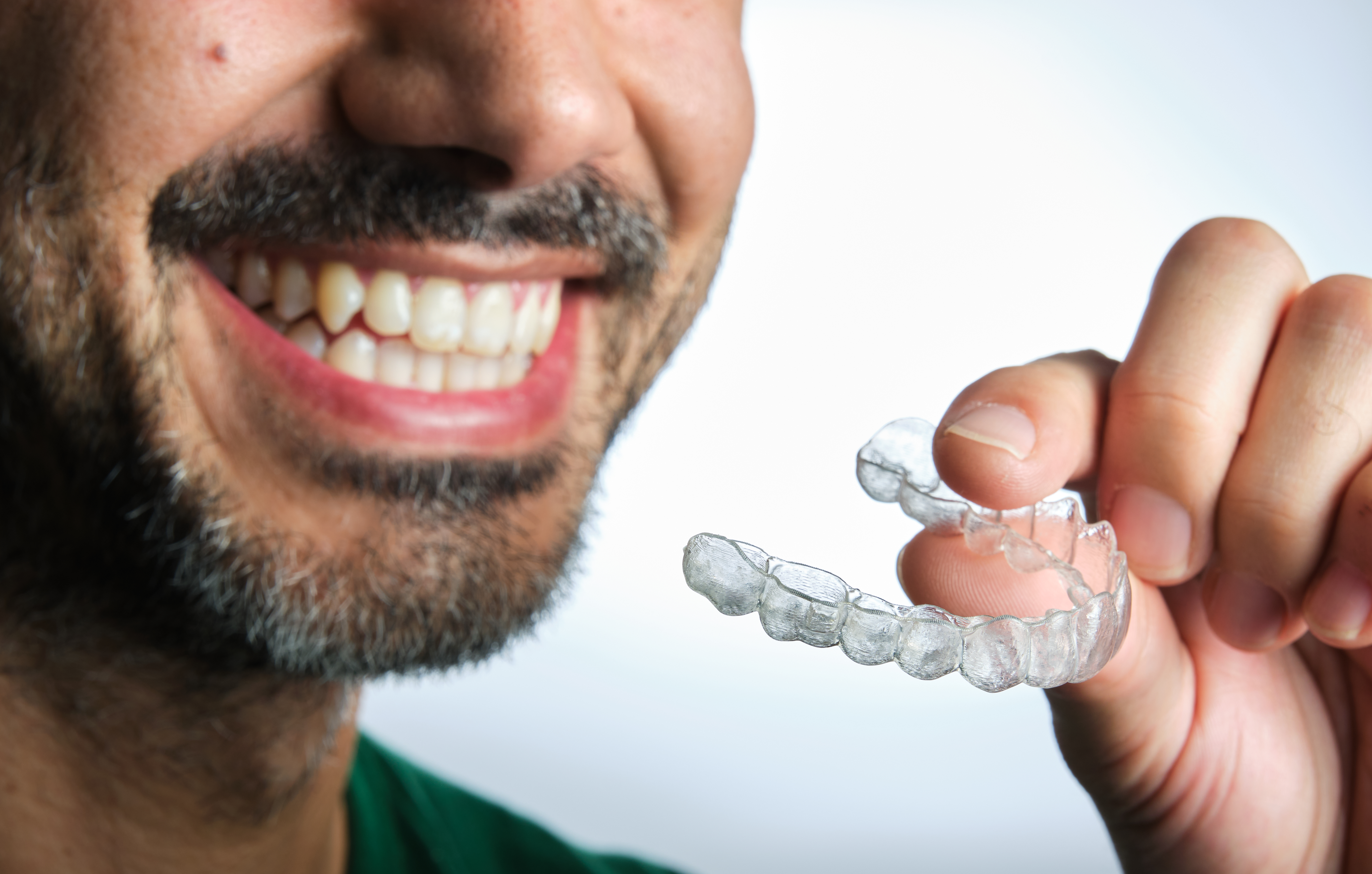 Custom occlusal splint close-up